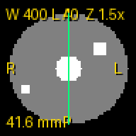 Synthetic axial phantom, slice 3: 52 rows x 0.8 mm = 41.6 mm